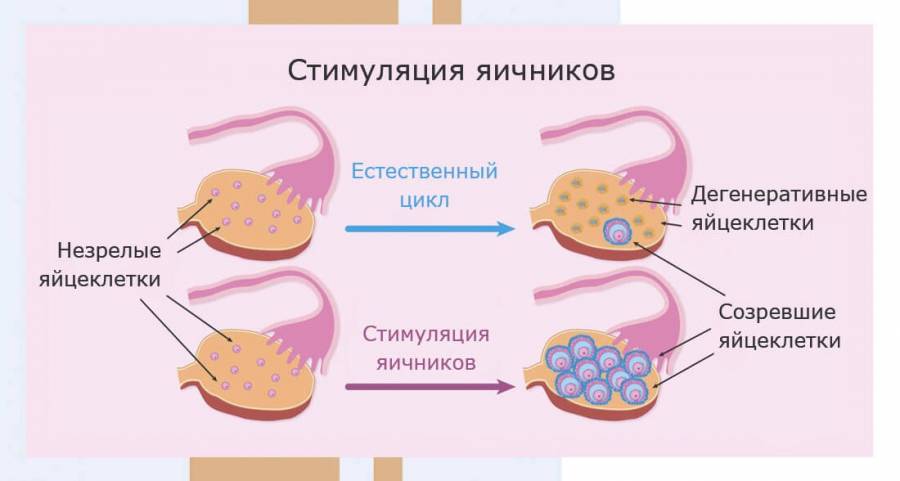 Миф про ЭКО: «Стимуляция уменьшает запас яйцеклеток и снижает АМГ»