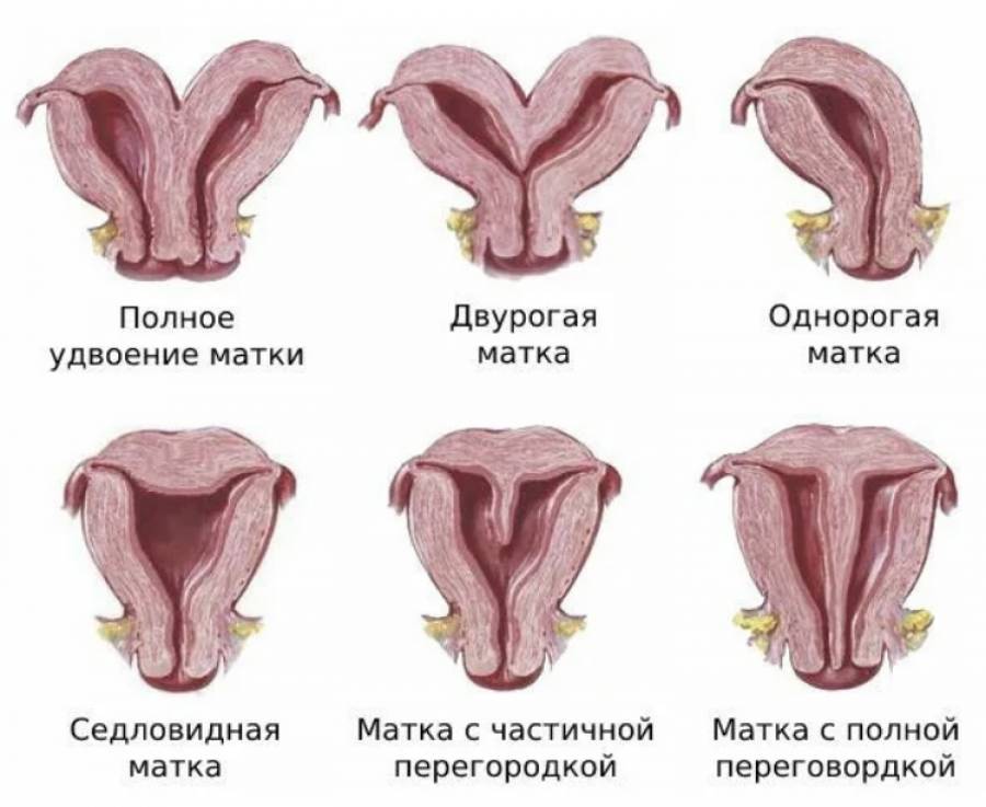 Врожденные пороки развития