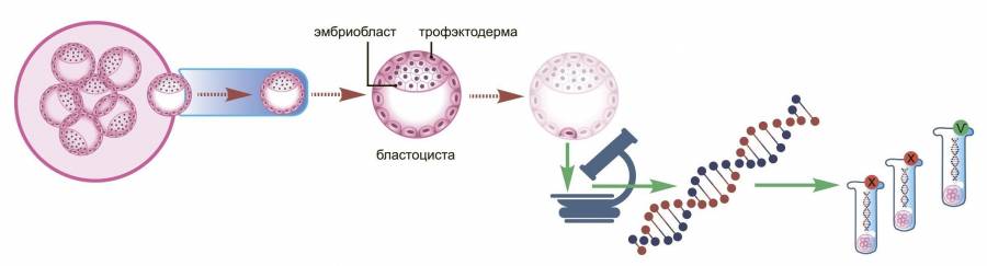 ЭКО с преимплантационным генетическим тестированием на моногенное заболевание (ПГТ-М)